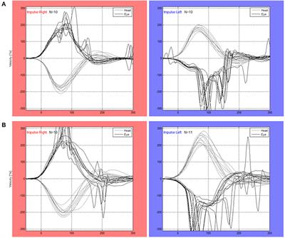 Short-Latency Covert Saccades - The Explanation for Good Dynamic Visual Performance After Unilateral Vestibular Loss?